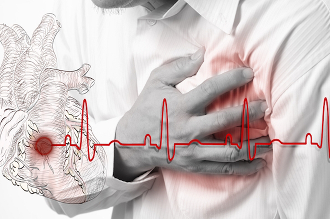 Ergonomia em Atendimento à uma PCR (Parada Cardiorrespiratória)